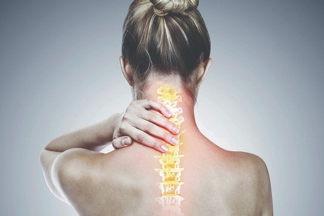 Servikal osteokondroz