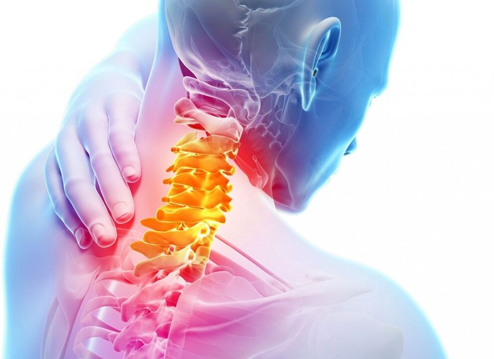 Servikal osteokondroz nedir