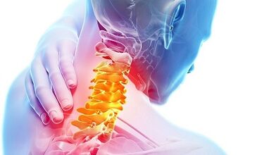 Servikal osteokondrozun nedenleri
