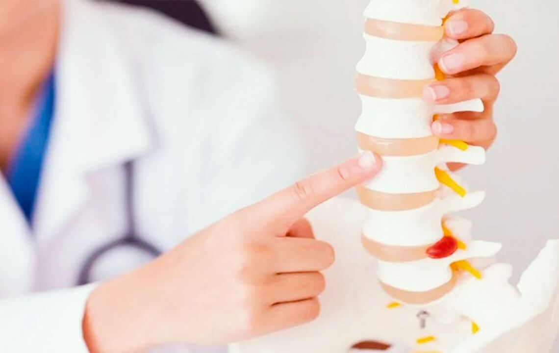 servikal osteokondroz nedeniyle omurgada hasar
